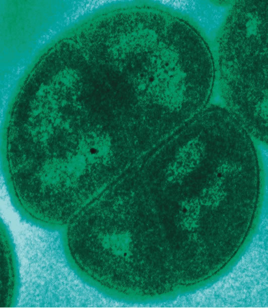 Deinococcus radiodurans Deinococcus radiodurans