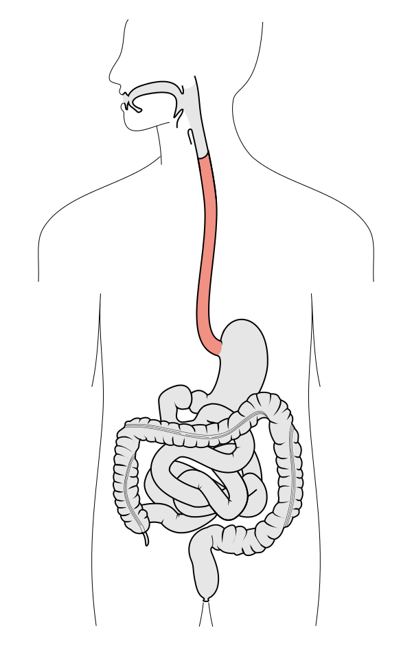 esophagus